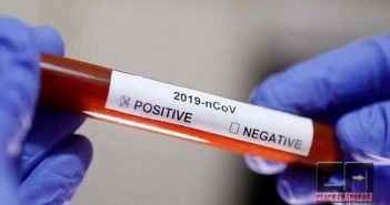 Taxa de positivo em testes indica que epidemia está subestimada no Brasil, diz OMS
